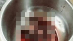 방광에 30cm 기생충이…인도 남성 ‘이것’ 먹었다가 감염
