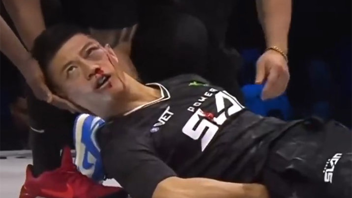 中 전통무술 계승자, 따귀 한방에 광대뼈 골절 ‘망신’