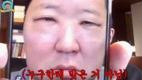 “병 앓는 사람 같았다”…정형돈, 성형으로 퉁퉁 부은 눈 인증