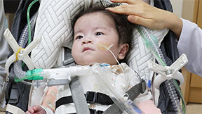 심장이 몸밖에 나온 아기… 서린이의 기적