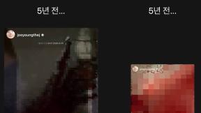 ‘활동 중단’ 차주영, 심각했던 코피 증상 “1시간 넘게…”