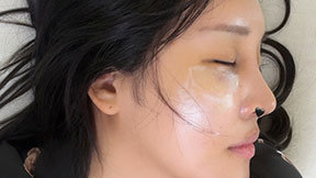 “부기 빠지면 병원 공개” 랄랄, 코 수술 후 자신감