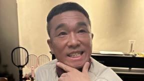 ‘성폭행 무혐의’ 김건모, 얼굴 확 달라졌다…“눈 밑 지방 끌어올려”