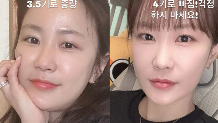 “이래도 되나 싶을 정도”…김지민, 시험관 시술 후 3.5kg 증량