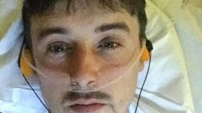 생식기 악취 참고 지내다가…결국 10cm 절단한 英 남성