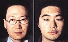 테너형(左) 바리톤형