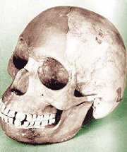 사람의 두개골과 오랑우탄의 턱뼈를 붙여 조작한 필트다운 인간의 화석