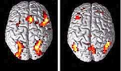 한자를 읽을 때(왼쪽)는 우반구의 시각 기능이 더 활성화된다.