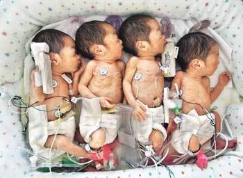 지난 3월 미국에서 태어난 일란성 네 쌍둥이