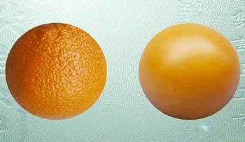 오렌지 껍질같은 피부도 시술로 효과를 볼 수 있다.