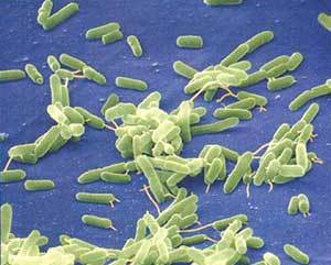 항생제가 듣지 않는 내성 녹농균을전자현미경으로 확대한 사진.