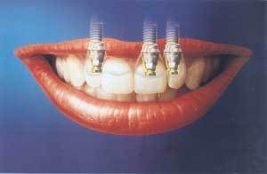 사진제공 브래네막·신원치재