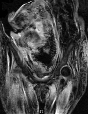 반 미라 상태로 발견된 436년 전 모자의 시신을 찍은 MRI(자기공명영상촬영) 사진. 태아가 거꾸로 누워 있는 상태에서 출산 중 숨졌다.-사진제공 고려대