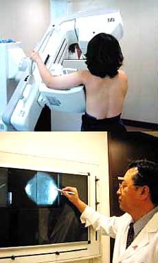 별다른 초기 증상이 없는 유방암은 조기 발견이 최선의 치료책이다(위).X선 사진에 나타난 유방암 병변. 흰 부분이 종양이다(아래).