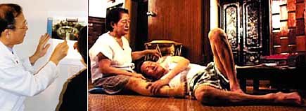 영화 ‘죽어도 좋아’의 한 장면(오른쪽). 노인의 임플란트는 의사와 충분히 상담하는 것이 중요하다(왼쪽).