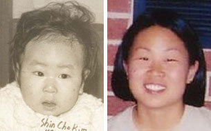 입양당시 사진(왼쪽)과 현재모습.