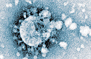 변종 코로나 바이러스.