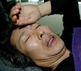 30일 인천공항에 도착한 개그맨 서세원씨가 허리 통증을 호소하며 들것에 실려 공항을 빠져나가고 있다. -인천=연합