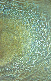 영국 킹스칼리지 연구팀이 공개한 인간배아줄기세포. 배양기에서 3주 동안 자란 모습이다. -동아일보 자료사진