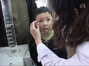 오른쪽 눈에 종양이 생기는 병을 앓고 있는 이유덕군이 주위의 도움으로 병원에서 치료를 받고 있다. 사진제공 SBS