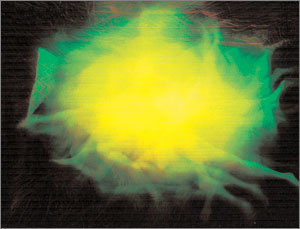 아타 작 ＇브로드 캐스팅＇ (2004년). 필름을 겹쳐 인화하거나 연속촬영하는 기법으로 시간의 변화를 화면에 표현했다. 마치 슬로모션처럼 화면 속 동작의 실루엣들이 겹치기도 하고 아예 한 가운데가 뿌옇게 처리되어 몽환적 분위기를 자아낸다. 남녀의 성애장면을 찍은 작품이다. 사진제공 가나화랑