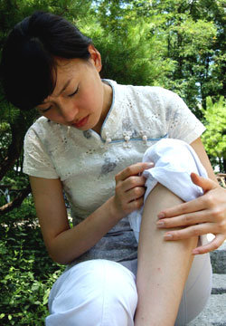 일반적으로 여자가 남자에 비해 멍이 잘든다. 일단 멍이 생기면 멍든 부위를 눌러주고 얼음찜질해야 멍이 커지는 것을 막을 수 있다. -동아일보 자료사진