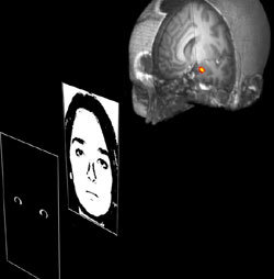 공포에 떠는 사람 눈의 흰자위(왼쪽)를 순간적으로 보여줬을 때 실험 대상자(가운데)의 뇌를 기능자기공명영상(fMRI) 장치로 촬영했다(오른쪽). 뇌 아랫부분의 편도체에서 반응이 활발히 일어난다. -사진제공 사이언스