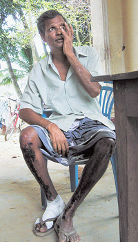 지진 해일로 가족 7명을 잃은 스리랑카의 어부 수닐산뜨씨. 그는 “가족이 없는 데 집을 다시 지어 무엇하느냐”며 한탄했다. 동아일보 자료사진