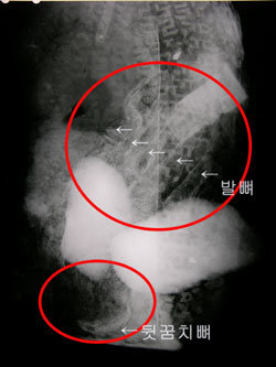 백제 금동신발을 X선으로 촬영한 사진. 오른발 뒤꿈치뼈가 왼쪽 아랫부분에 초승달 모양으로 희미하게 보이고, 가운뎃부분에 5개의 발뼈가 보인다. 사진 제공 국립부여문화재연구소