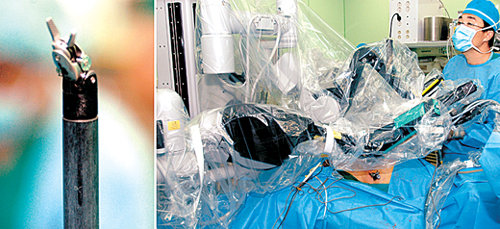 서울 신촌세브란스병원 의료진이 18일 미국에서 들여온 수술전문용 로봇 ‘다빈치’를 이용해 쓸개 혹 절제수술을 하고 있다. 왼쪽은 로봇의 수술팔. 사진 제공 신촌세브란스병원