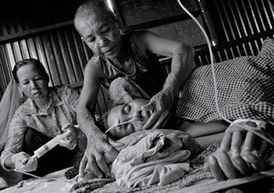 캄보디아의 마을에서 한 어머니가 뇌막염과 에이즈, 결핵을 앓고 있는 33세의 딸을 돌보고 있다. 소크 팀 씨가 설립한 비정부기구 ‘캄보디아 보건 위원회(CHC)’가 이들에게 약과 간병인을 지원해 주고 있다. 사진 제공 타임