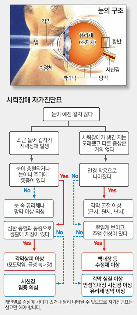 건강]눈앞이 캄캄… 세상이 삐뚤… “빨리 응급실로”｜동아일보