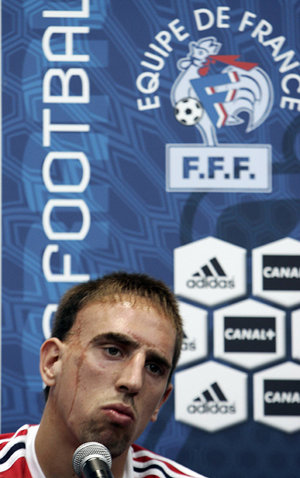 프랑스 축구 대표팀 프랑크 리베리가 14일(현지시간) 기자회견에서 18일 열리는 한국전 승리를 자신했다.(AFP)