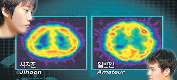 내셔널지오그래픽이 다큐멘터리 프로그램 ‘월드사이버게임스’에서 프로게이머 서지훈 선수와 일반인이 컴퓨터 게임을 하는 동안 뇌 운동을 비교하는 실험을 했다. 실험 결과 활성화되는 뇌 부분이 서로 달랐다. 사진 제공 내셔널지오그래픽