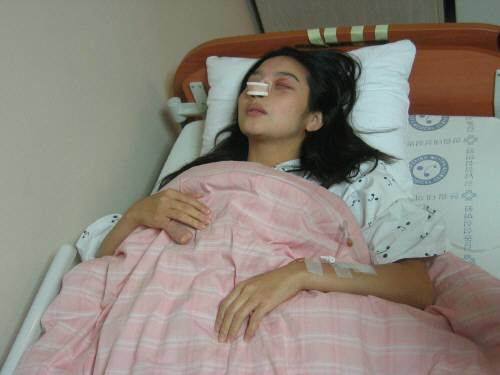 동료 배우 이찬과의 신혼여행 직후 파경으로 충격을 던져주고 있는 탤런트 이민영 측이 이찬으로부터의 폭행설을 주장하고 나서면서 공개한 사진. 연합