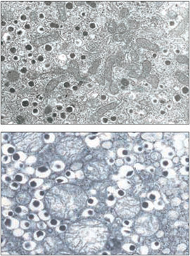 쥐의 췌장 베타세포를 1만 배 확대한 모습. 저단백 먹이를 먹은 어미에게서 태어난 쥐(위)의 경우 미토콘드리아가 길쭉해졌다. 일반 사료를 먹은 어미가 낳은 쥐의 미토콘드리아는 둥근 모양이다. 사진 제공 원자력병원·서울대