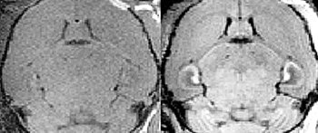 일반 자기공명영상(MRI) 장치로 촬영한 뇌 단면 사진(왼쪽)과 산화망간 나노입자로 만든 조영제를 주입해 찍은 사진. 조영제를 투입해 찍은 오른쪽 사진은 동일 부위를 해부해 찍은 사진과 거의 비슷할 정도로 선명하게 보인다. 사진 제공 과학기술부