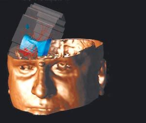 미국 뉴욕대 의학센터에서 만든 청각 자극을 나타내는 3D 영상 스캔. 잠자는 동안 뇌는 아주 큰 소리를 제외하고 어떤 청각 정보에도 중요성을 부여하지 않는다. 사진 제공 북센스