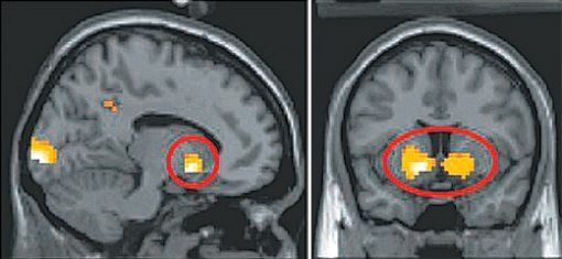 뇌의 보상센터에 속하는 배쪽 줄무늬체를 실험 참가자의 머리 오른쪽(왼쪽)과 뒤에서 촬영한 영상. 참가자가 자신은 돈을 받고 상대방은 받지 못했을 때 이 영역이 가장 활발하게 활동했다. 사진 제공 사이언스