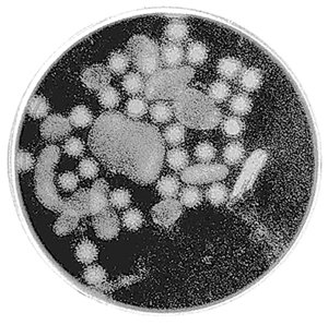 겨울 식중독 원인인 노로바이러스.