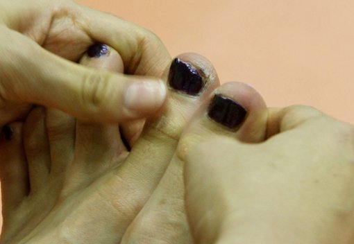 ▲나도 여자랍니다 국가대표 여자배구 선수의 발톱. 강 훈련에 부러진 엄지발톱이지만 곱게 매니큐어를 칠했다. 엄격한 선수촌 생활 속에서도 청춘의 발랄함은 숨쉰다.