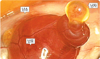 난소의 난포 조직에서 난자가 빠져나오고 있다. 중년 여성의 자궁절제수술 도중 우연히 찍힌 이 영상은 인간의 배란 과정에 대한 여러 가지 정보를 제공할 것으로 기대되고 있다. 사진 출처 BBC 홈페이지