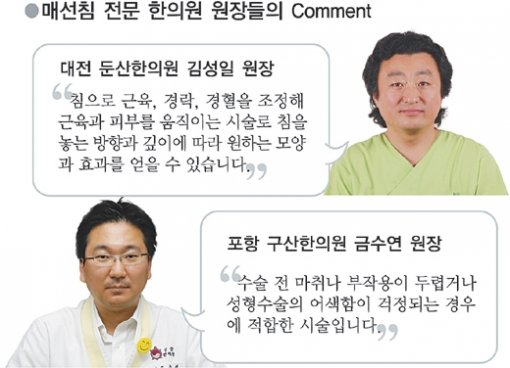 건강]질병치료에서 미용성형까지 한방침술의 발전은 어디까지?｜동아일보