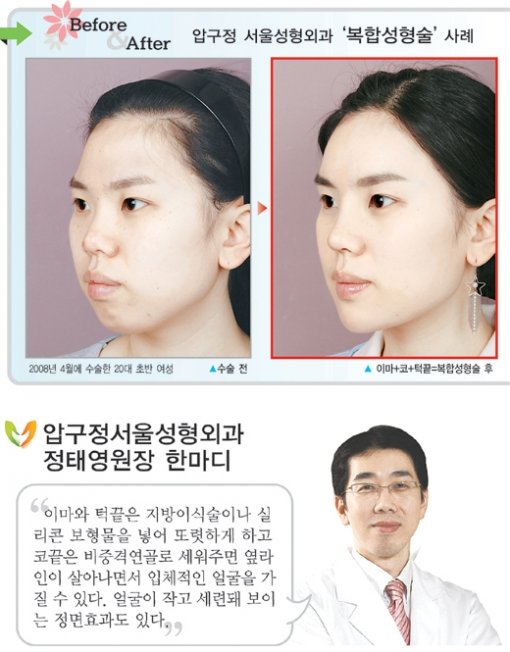 건강]'이목구비 미인' 가고 '입체 미인' 뜬다｜동아일보