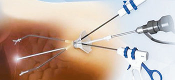 구멍 한 개에 카메라 장치와 수술 기구가 동시에 삽입된 장면. 사진 제공 올림푸스