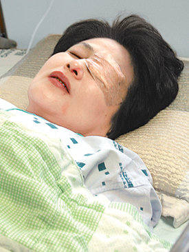 폭행 당한 法治27일 국회에서 부산 민주화실천가족운동협의회 회원에게 폭행을 당해 서울 용산구 순천향대병원에 입원한 한나라당 전여옥 의원. 전 의원은 왼쪽 눈의 각막과 결막이 손상되고 온몸에 타박상을 입었다. 이훈구 기자