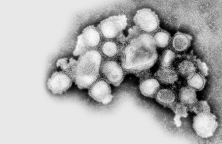 미국 질병통제예방센터(CDC)가 28일 돼지인플루엔자에 감염된 미국 환자로부터 추출한 바이러스(H1N1)의 전자현미경 사진. 로이터 연합뉴스