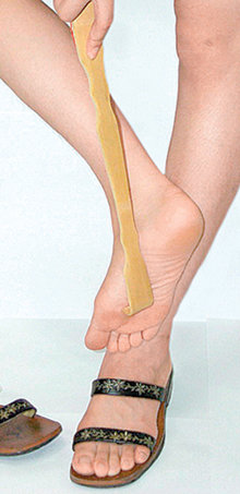 발 무좀은 남녀 예외가 없다. 평소 땀이 차지 않도록 청결하게 관리하는 것이 최선이다. 동아일보 자료 사진