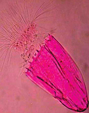 세계 최초로 발견된 산소 없이 사는 동물. 길이가 1mm가 채 안되는 이 동물은 해저 3250m보다 더 깊은 퇴적층에서 발견됐다. 사진 출처 라이브사이언스닷컴