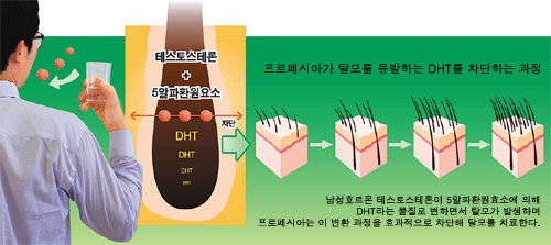 남성 탈모는 남성 호르몬 테스토스테론이 체내 5-알파 환원효소와 만나, 탈모를 유발하는 DHT로 변환되는 과정에서 일어난다. 세계 최초 먹는 탈모치료제인 프로페시아 이 과정을 차단한다. 탈모가 진행되는 초기, 6개월 이상 매일 복용하면 효과를 볼 수 있다. 그래픽 제공 한국MSD